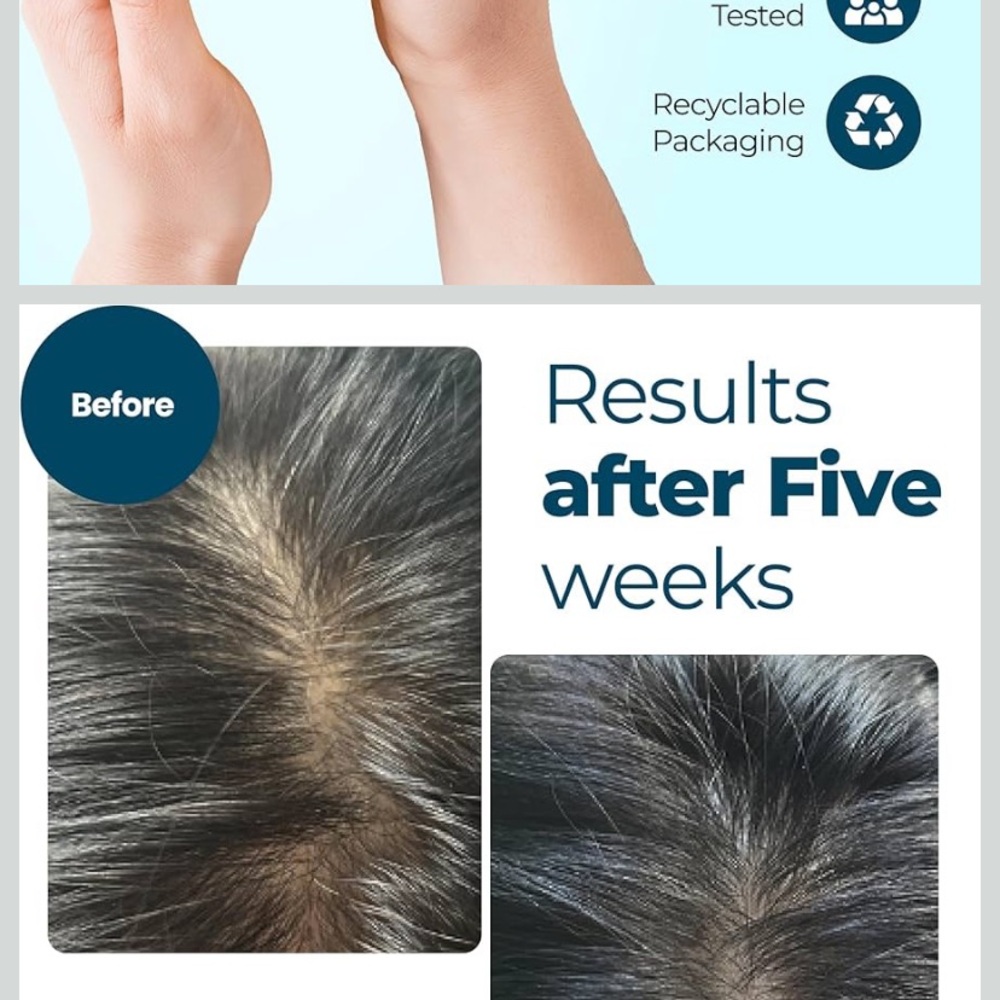 Hair Growth Oil - Black Packaging - Picture 4 of 16